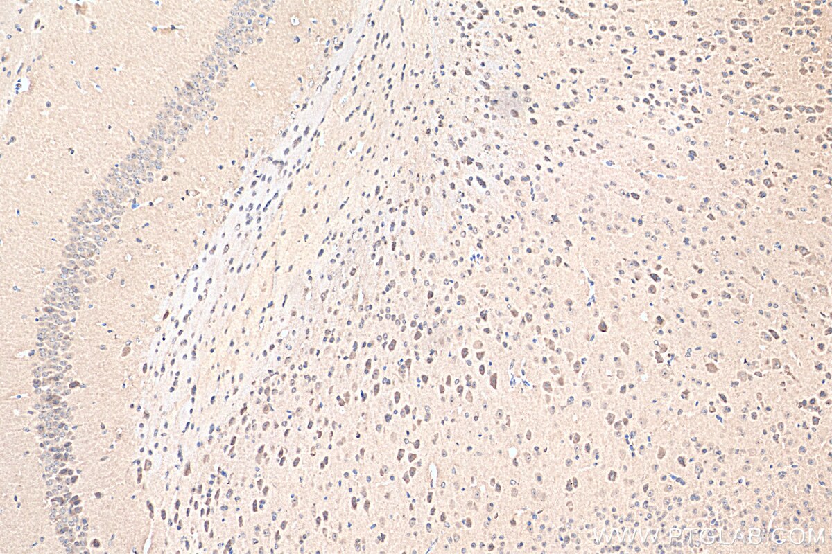 Immunohistochemistry (IHC) staining of mouse brain tissue using ANKS1B Polyclonal antibody (24783-1-AP)