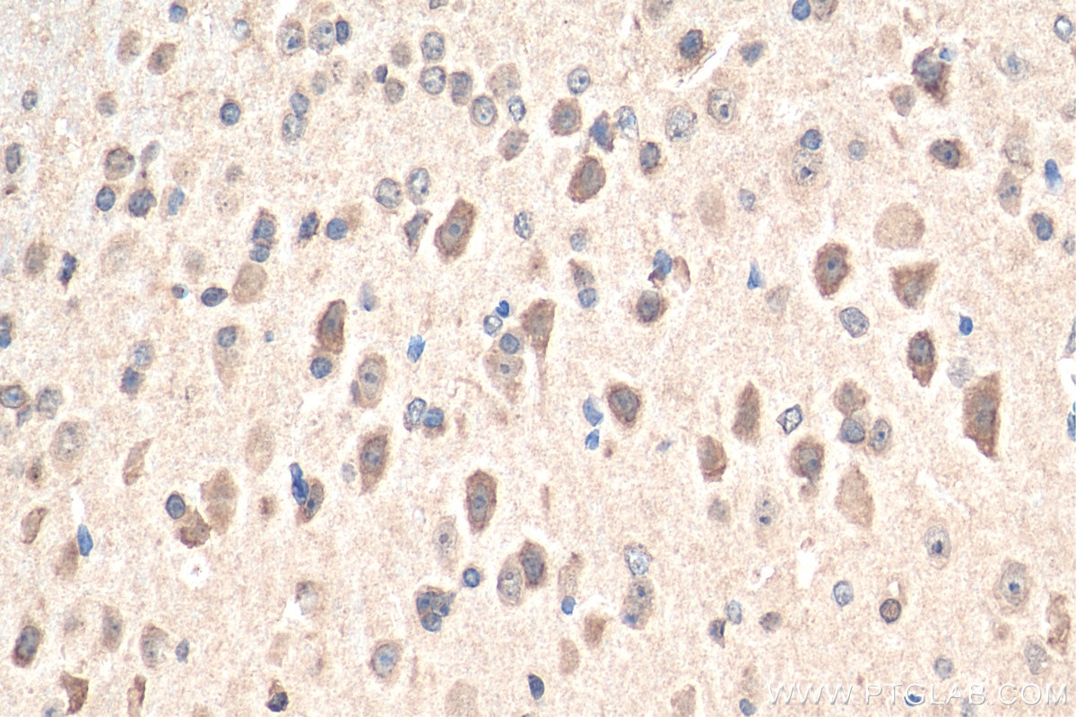 Immunohistochemistry (IHC) staining of mouse brain tissue using ANKS1B Polyclonal antibody (24783-1-AP)
