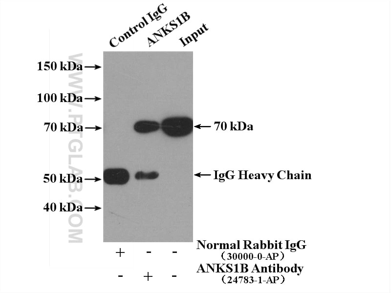 Immunoprecipitation (IP) experiment of HeLa cells using ANKS1B Polyclonal antibody (24783-1-AP)