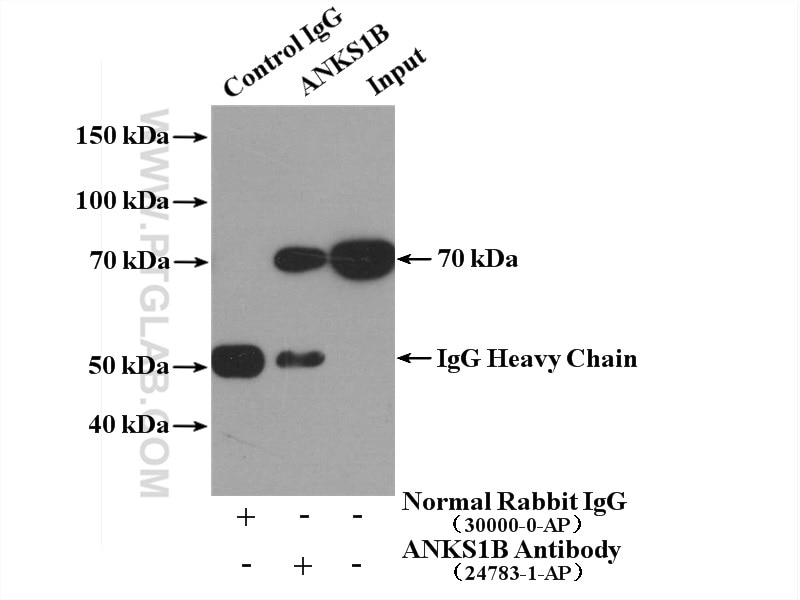 IP experiment of HeLa using 24783-1-AP