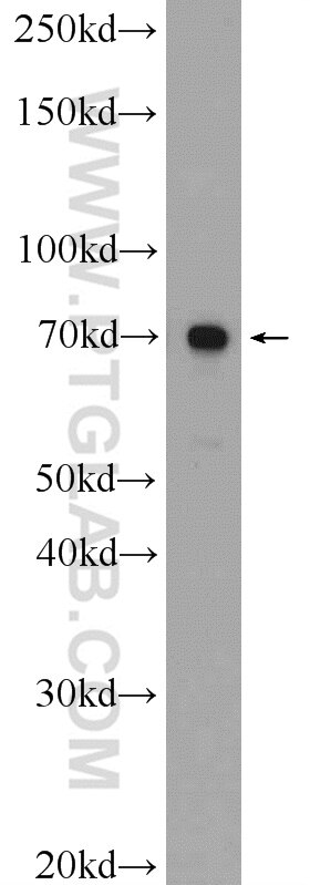 Western Blot (WB) analysis of mouse testis tissue using ANKS1B Polyclonal antibody (24783-1-AP)