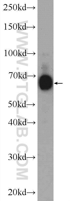 Western Blot (WB) analysis of HeLa cells using ANKS1B Polyclonal antibody (24783-1-AP)