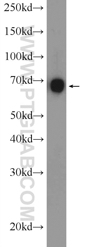 Western Blot (WB) analysis of A549 cells using ANKS1B Polyclonal antibody (24783-1-AP)