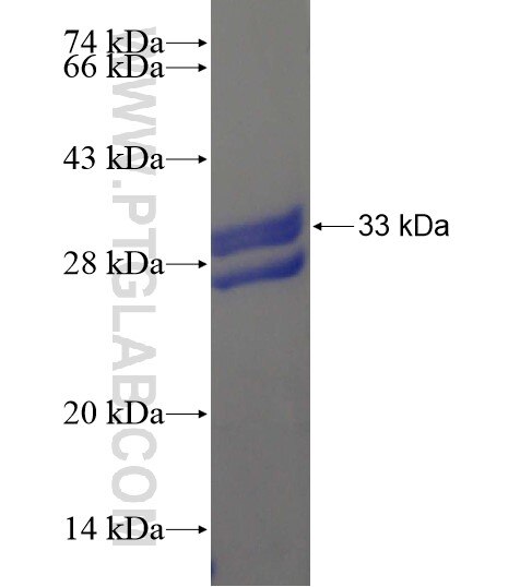 ANKS1B fusion protein Ag20454 SDS-PAGE