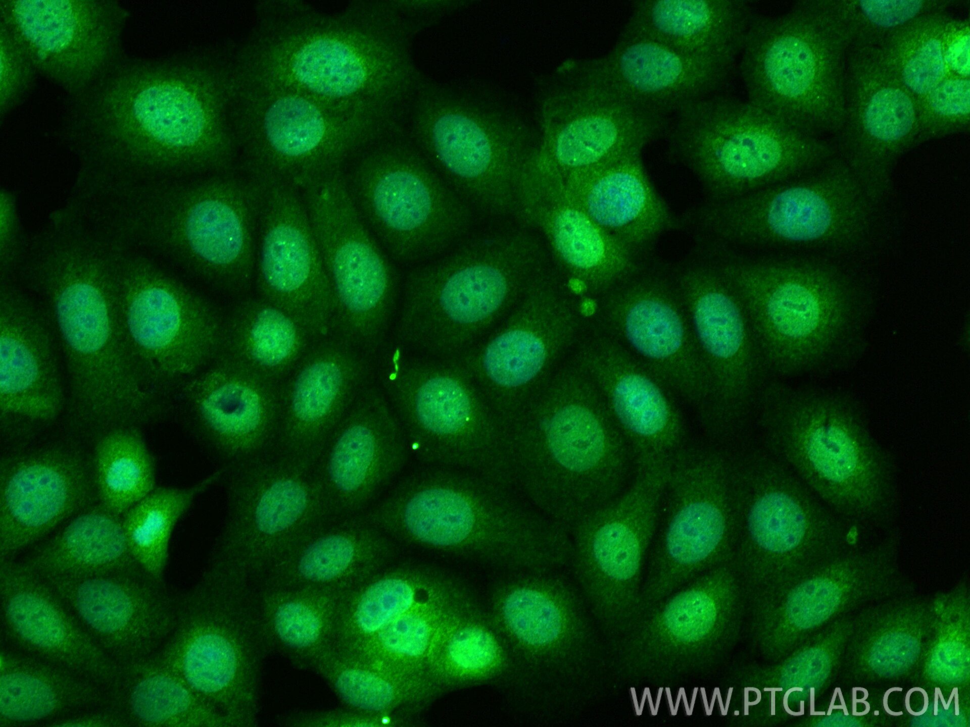 Immunofluorescence (IF) / fluorescent staining of MCF-7 cells using ANKS3 Polyclonal antibody (24058-1-AP)
