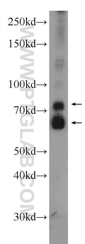 Western Blot (WB) analysis of mouse liver tissue using ANKS3 Polyclonal antibody (24058-1-AP)