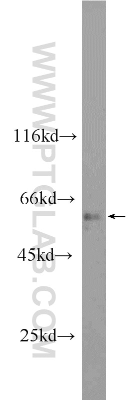Western Blot (WB) analysis of human brain tissue using ANKS3 Polyclonal antibody (24058-1-AP)