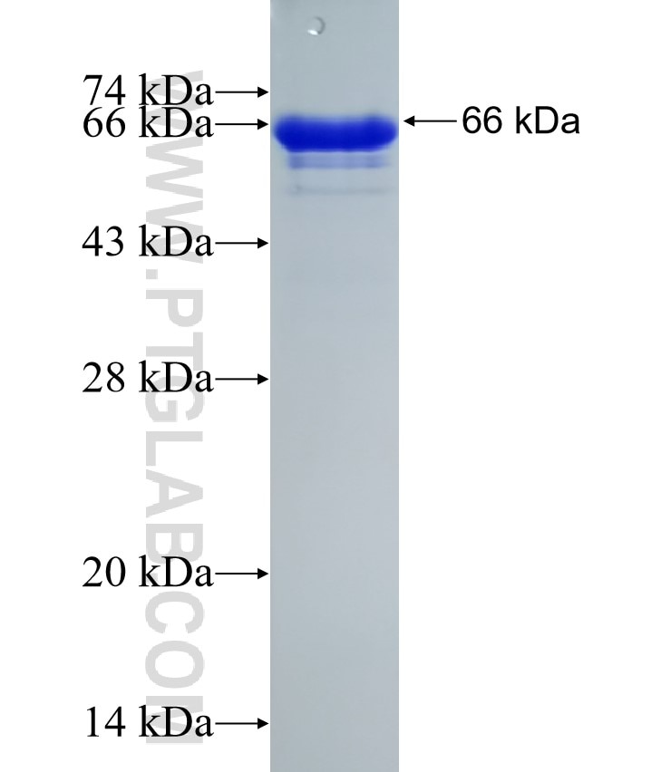 ANKS3 fusion protein Ag21252 SDS-PAGE