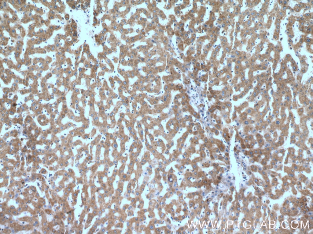 Immunohistochemistry (IHC) staining of human liver tissue using ANKZF1 Polyclonal antibody (20447-1-AP)