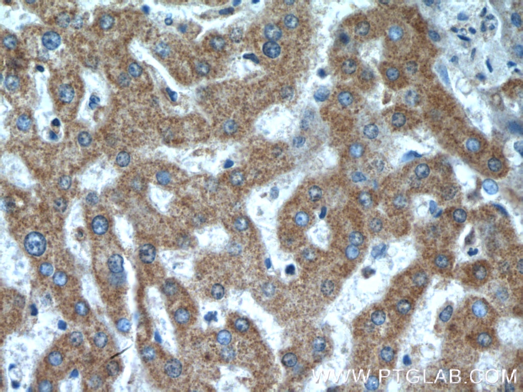 Immunohistochemistry (IHC) staining of human liver tissue using ANKZF1 Polyclonal antibody (20447-1-AP)