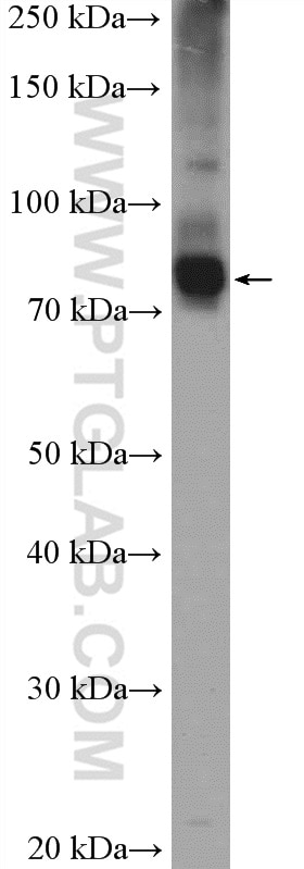 Western Blot (WB) analysis of HeLa cells using ANKZF1 Polyclonal antibody (20447-1-AP)