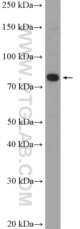 Western Blot (WB) analysis of COLO 320 cells using ANKZF1 Polyclonal antibody (20447-1-AP)
