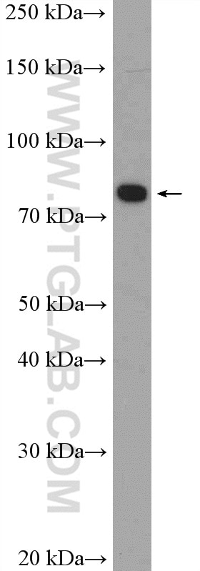 WB analysis of COLO 320 using 20447-1-AP