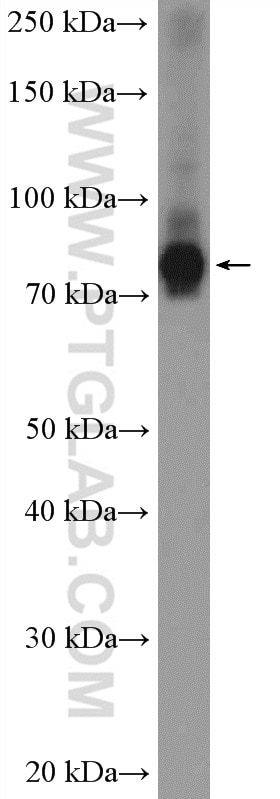 WB analysis of BxPC-3 using 20447-1-AP