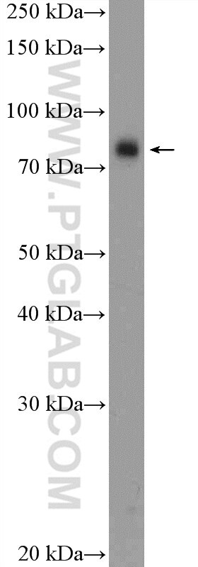 Western Blot (WB) analysis of MCF-7 cells using ANKZF1 Polyclonal antibody (20447-1-AP)