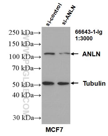 WB analysis of MCF-7 using 66643-1-Ig