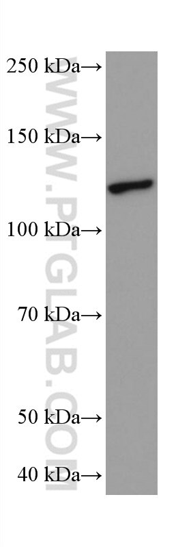 Western Blot (WB) analysis of rat brain tissue using ANLN Monoclonal antibody (66643-1-Ig)