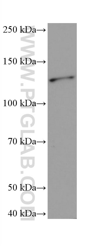 Western Blot (WB) analysis of mouse brain tissue using ANLN Monoclonal antibody (66643-1-Ig)