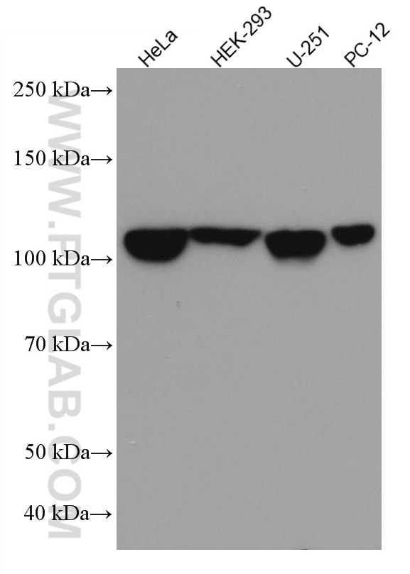 Western Blot (WB) analysis of various lysates using ANLN Monoclonal antibody (66643-1-Ig)