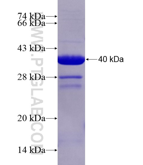 ANLN fusion protein Ag19294 SDS-PAGE