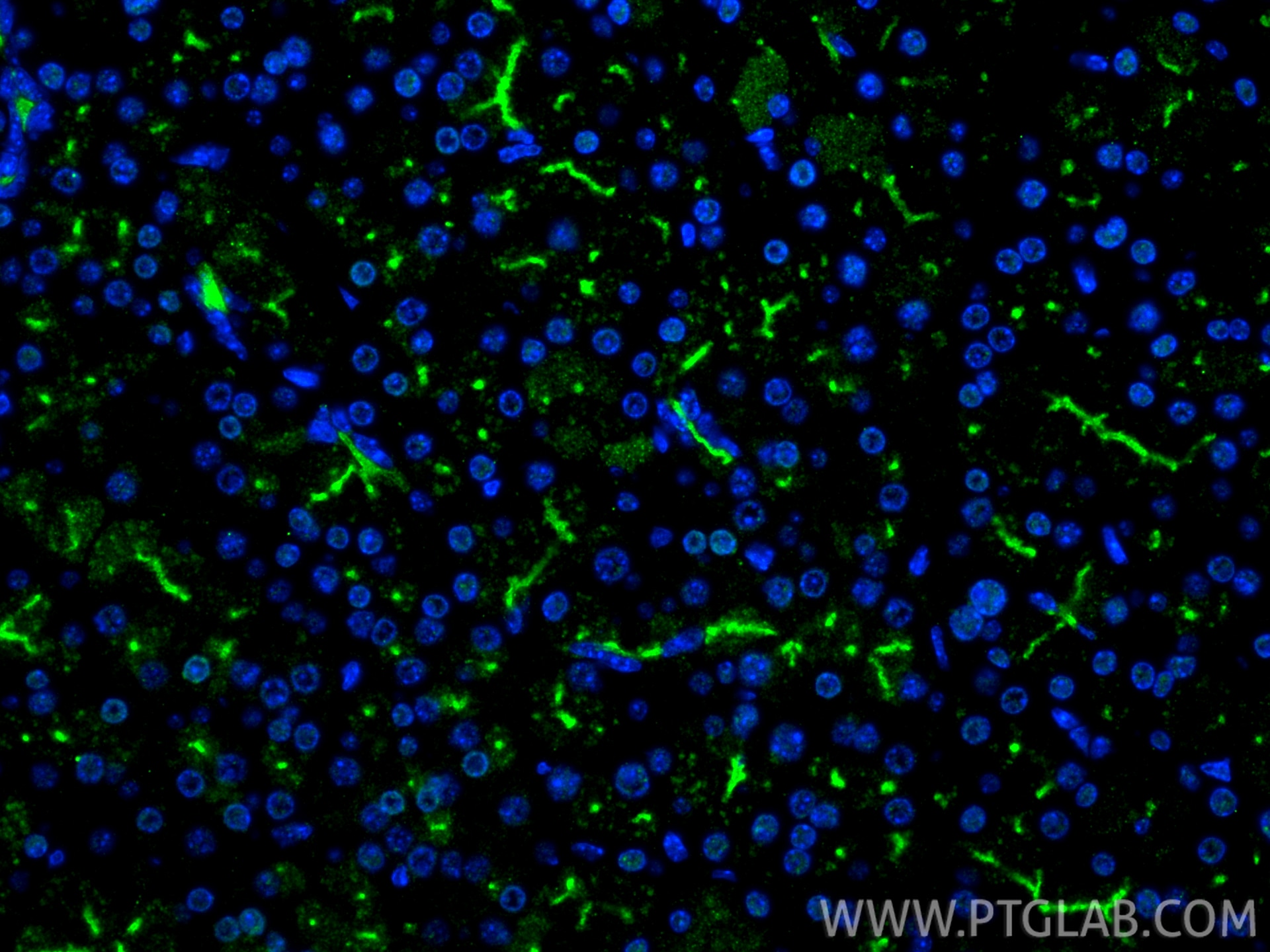 Immunofluorescence (IF) / fluorescent staining of mouse pancreas tissue using TMEM16A/DOG1 Polyclonal antibody (12652-1-AP)