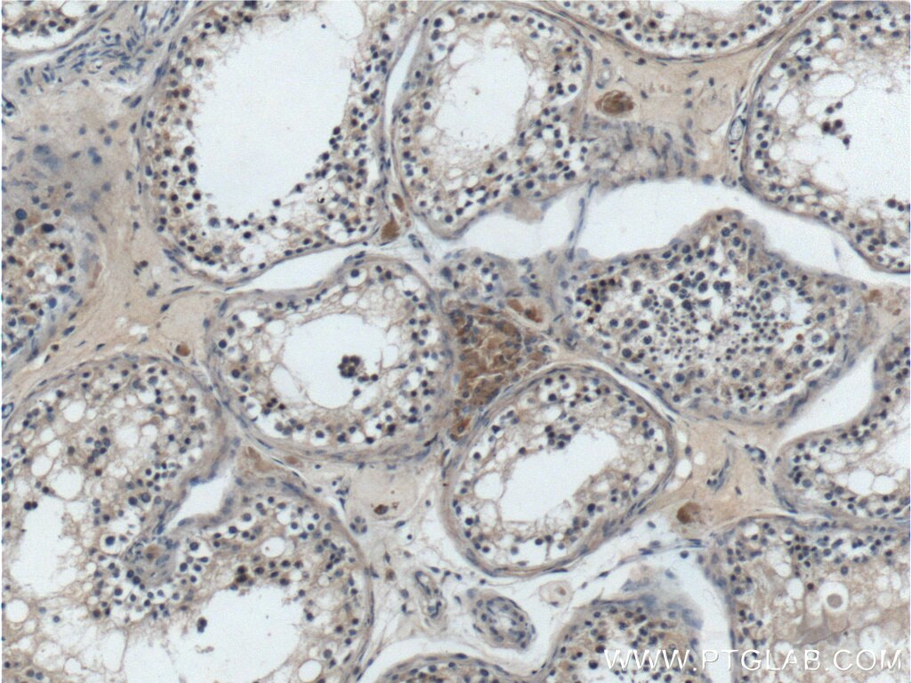 Immunohistochemistry (IHC) staining of human testis tissue using ANO10 Polyclonal antibody (21901-1-AP)