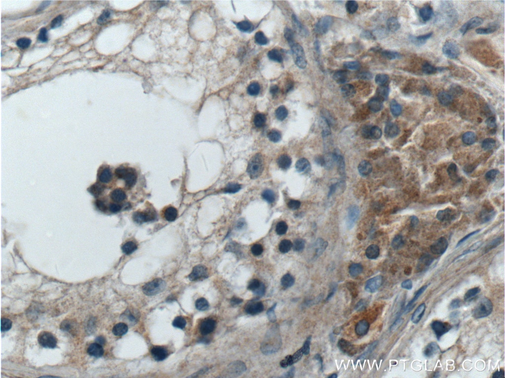Immunohistochemistry (IHC) staining of human testis tissue using ANO10 Polyclonal antibody (21901-1-AP)