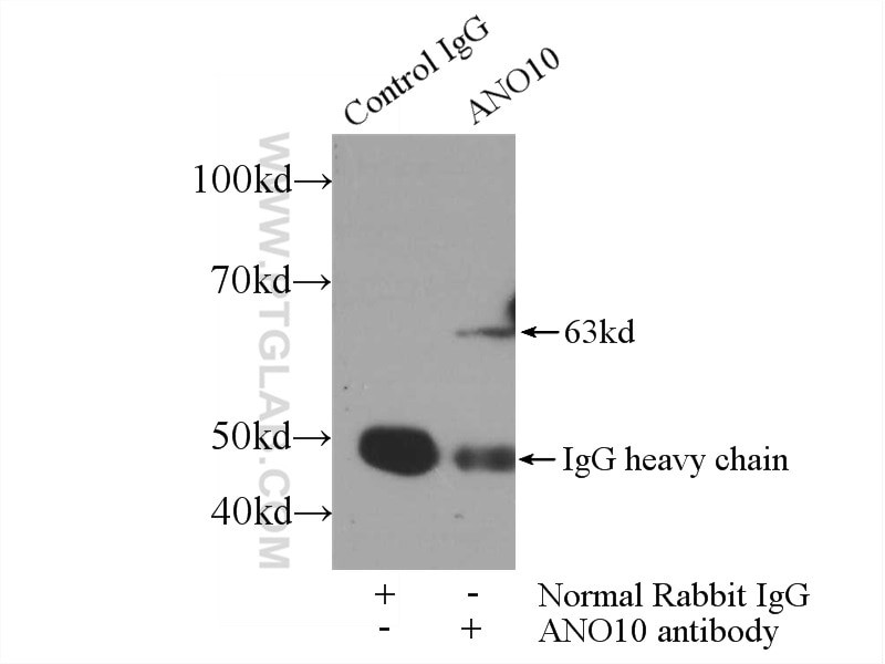 Immunoprecipitation (IP) experiment of mouse brain tissue using ANO10 Polyclonal antibody (21901-1-AP)