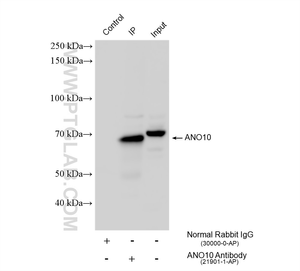 IP result of anti-ANO10 (IP:21901-1-AP, 4ug; Detection:21901-1-AP 1:2000) with mouse brain tissue lysate 1960 ug. Immunoprecipitation (IP) experiment of mouse brain tissue using ANO10 Polyclonal antibody (21901-1-AP)
