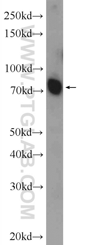 Western Blot (WB) analysis of mouse brain tissue using ANO10 Polyclonal antibody (21901-1-AP)