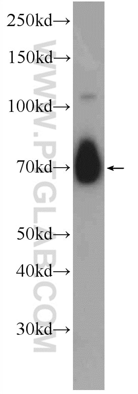 Western Blot (WB) analysis of mouse brain tissue using ANO10 Polyclonal antibody (21901-1-AP)