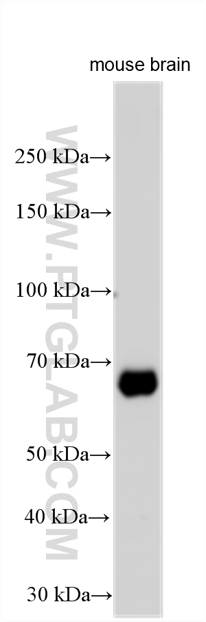 Western Blot (WB) analysis of various lysates using ANO10 Polyclonal antibody (21901-1-AP)
