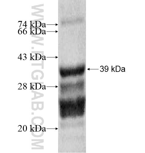 ANO10 fusion protein Ag13935 SDS-PAGE
