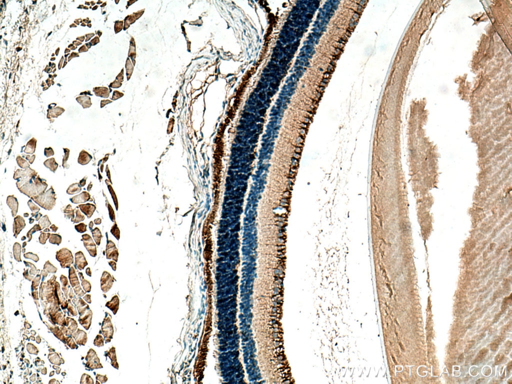 Immunohistochemistry (IHC) staining of mouse eye tissue using ANO2 Polyclonal antibody (20647-1-AP)