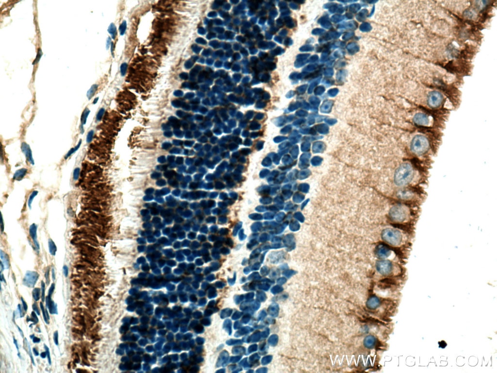 Immunohistochemistry (IHC) staining of mouse eye tissue using ANO2 Polyclonal antibody (20647-1-AP)