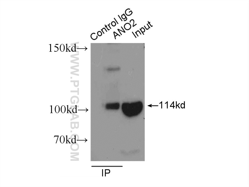Immunoprecipitation (IP) experiment of mouse brain tissue using ANO2 Polyclonal antibody (20647-1-AP)