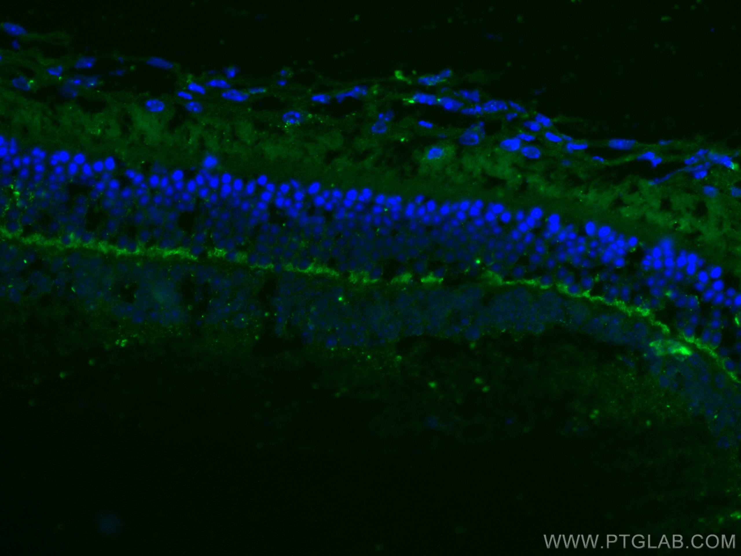 Immunofluorescence (IF) / fluorescent staining of mouse eye tissue using ANO2 Monoclonal antibody (67638-1-Ig)