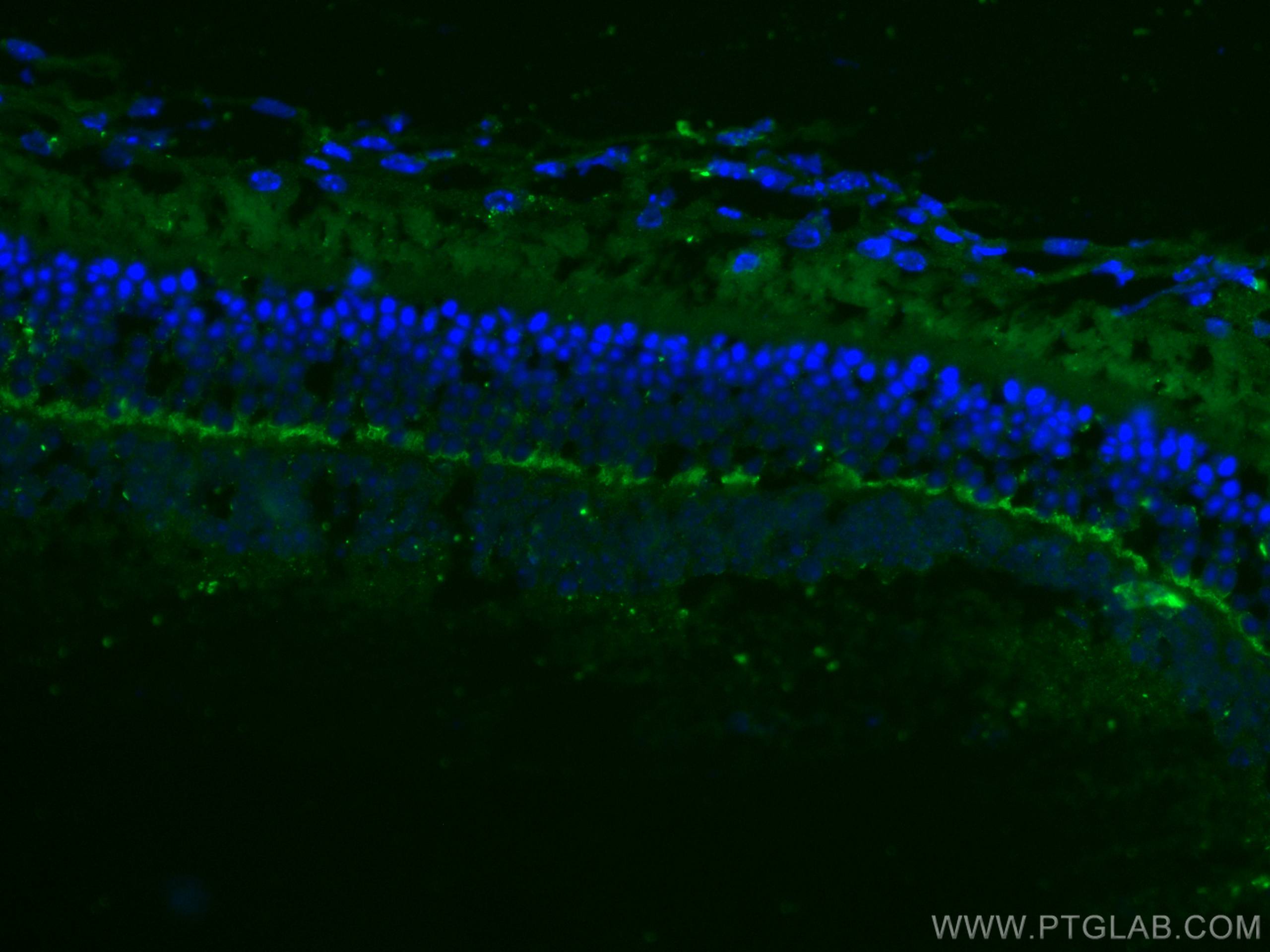 Immunofluorescence (IF) / fluorescent staining of mouse eye tissue using ANO2 Monoclonal antibody (67638-1-Ig)