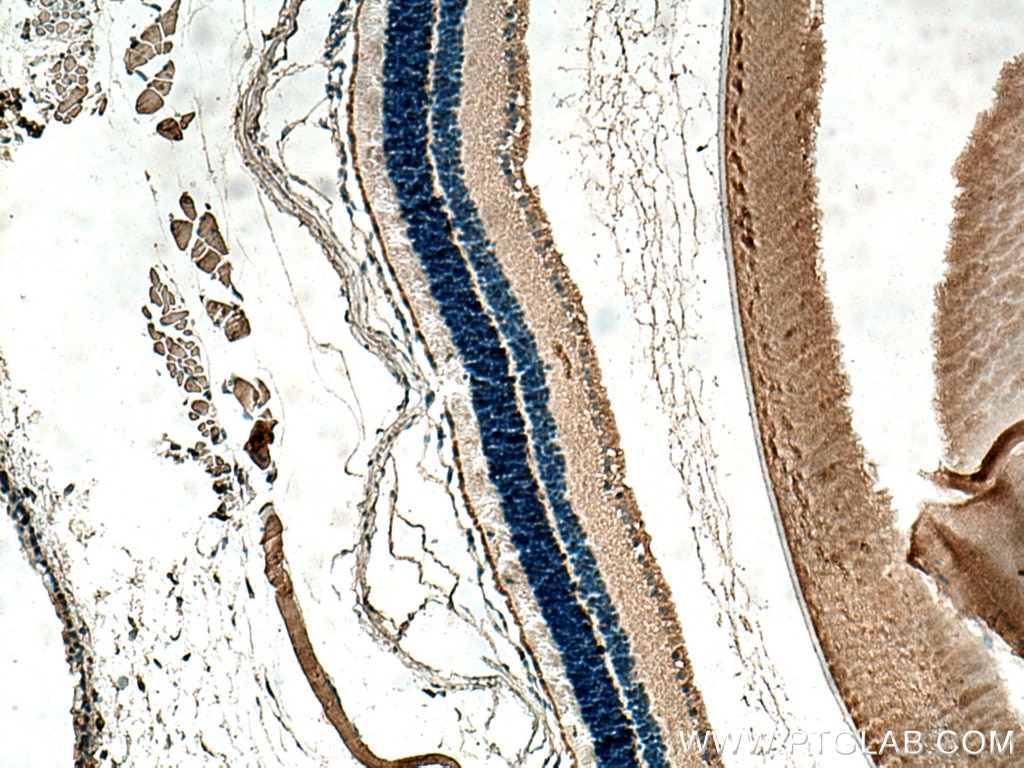 Immunohistochemistry (IHC) staining of mouse eye tissue using ANO2 Monoclonal antibody (67638-1-Ig)