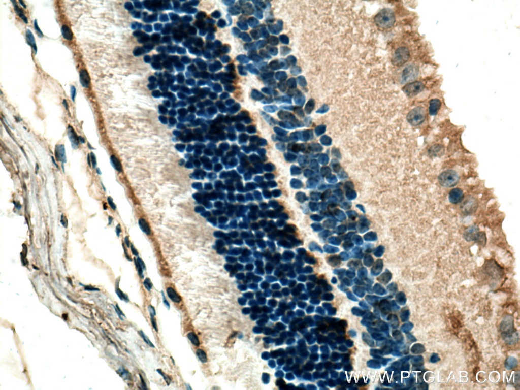 Immunohistochemistry (IHC) staining of mouse eye tissue using ANO2 Monoclonal antibody (67638-1-Ig)