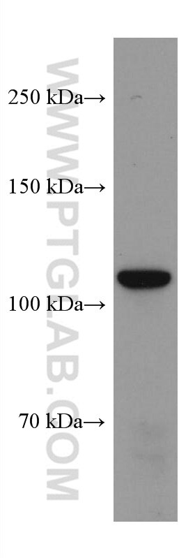 Western Blot (WB) analysis of NCCIT cells using ANO2 Monoclonal antibody (67638-1-Ig)