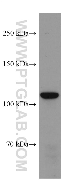 Western Blot (WB) analysis of NCCIT cells using ANO2 Monoclonal antibody (67638-1-Ig)