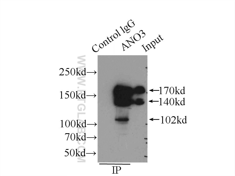 Immunoprecipitation (IP) experiment of mouse testis tissue using ANO3 Polyclonal antibody (19489-1-AP)