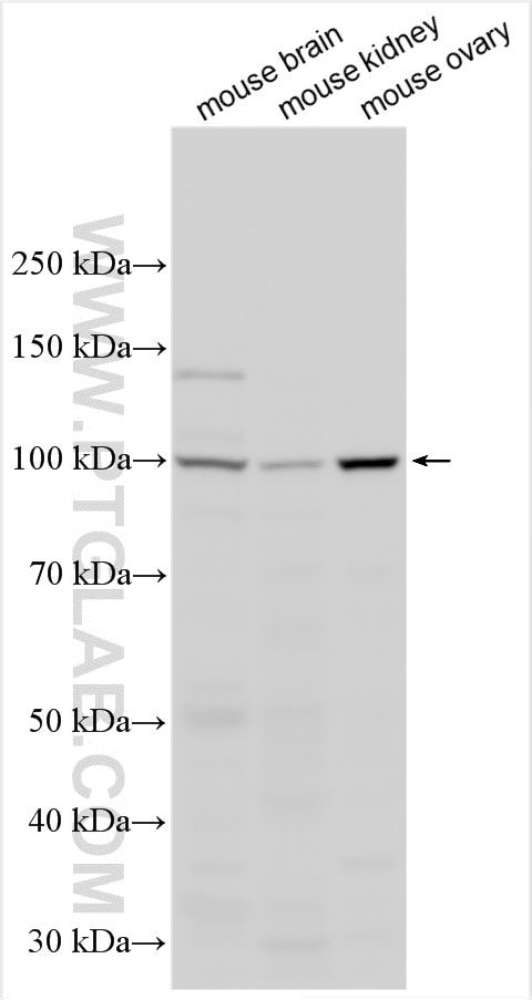 Western Blot (WB) analysis of various lysates using ANO3 Polyclonal antibody (19489-1-AP)