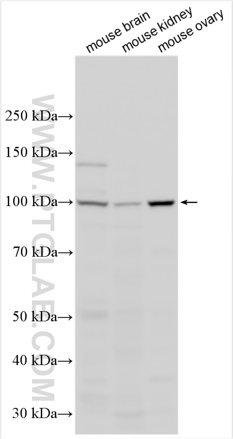 WB analysis using 19489-1-AP