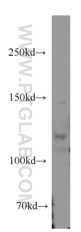 Western Blot (WB) analysis of mouse skin tissue using ANO3 Polyclonal antibody (19489-1-AP)