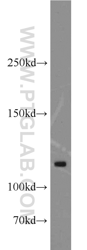 Western Blot (WB) analysis of mouse ovary tissue using ANO3 Polyclonal antibody (19489-1-AP)