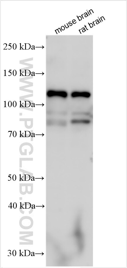 Western Blot (WB) analysis of various lysates using ANO4 Polyclonal antibody (19488-1-AP)