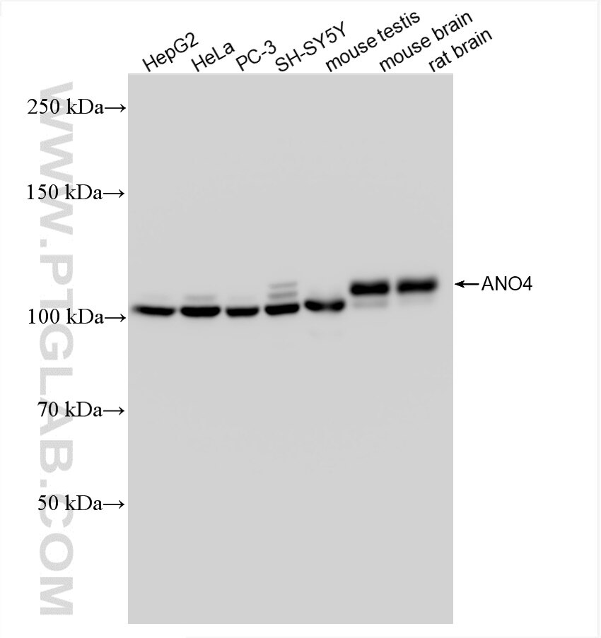 Western Blot (WB) analysis of various lysates using ANO4 Recombinant antibody (82970-1-RR)