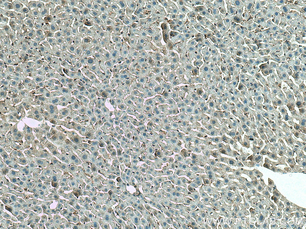 Immunohistochemistry (IHC) staining of mouse liver tissue using ANO6 Polyclonal antibody (20784-1-AP)